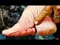 The HORRIFYING History of Foot Binding