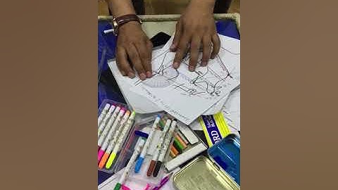 steiner cephalometric analysis/ SNA angle.