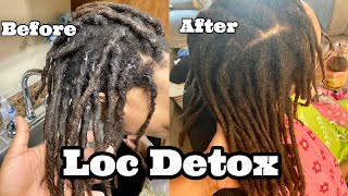 Loc Detox | First ACV Rinse on 3 Year Old Locs