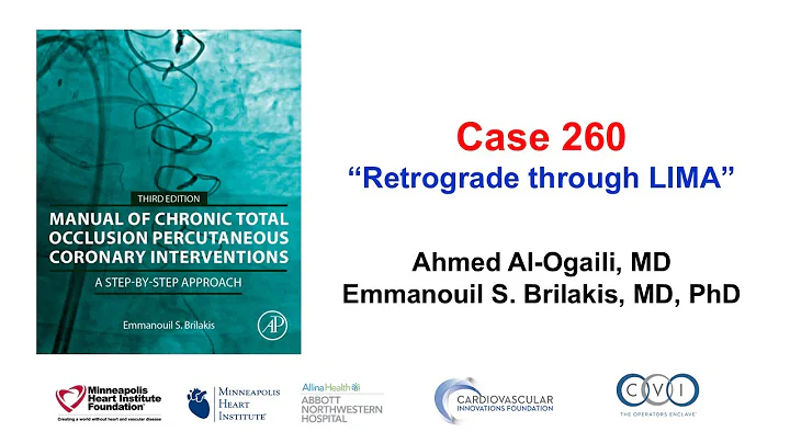 Case 260: Manual of CTO PCI - Retrograde through LIMA