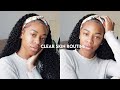 HOW TO GET CLEAR SKIN | HOW TO FADE DARK SPOTS + HYPERPIGMENTATION