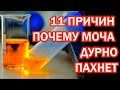 Запах мочи как сигнал болезни: 11 причин, что вы пахнете аммиаком или еще хуже