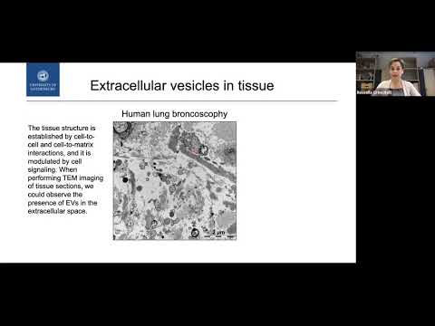 Extracellular vesicle subpopulations