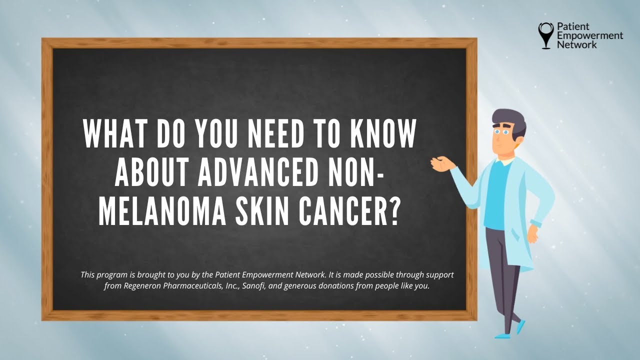 What Do You Need to Know About Advanced Non-Melanoma Skin Cancer? - YouTube