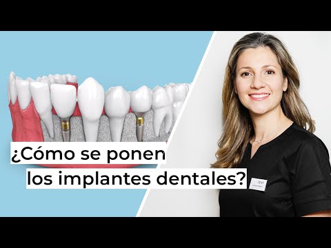 Video: ¿De quién son los trabajos dentales?