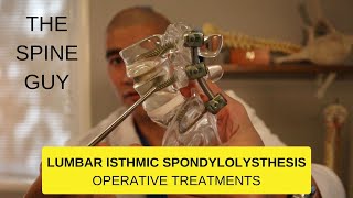 Lumbar Isthmic Spondylolisthesis - Part 3 - Surgical Treatments
