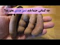 چه کسانی حتما باید تمبر هندی بخورند؟