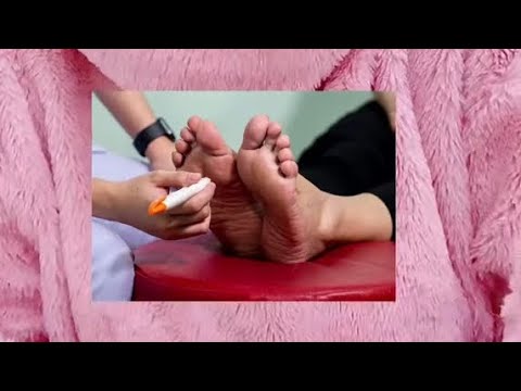 متى يكون التنميل خطير د اسلام بركات