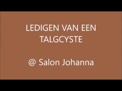 Video: Hoe Een Cyste Te Laten Knallen: Op Je Gezicht, Rug, Thuis En Meer