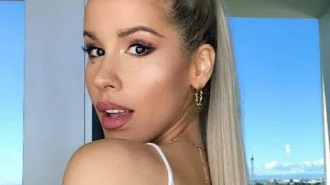 Cosa ha sotto l'occhio Baby K?