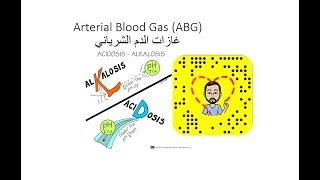 تخصص التمريض | غاز الدم الشرياني - Arterial Blood Gas (ABG)