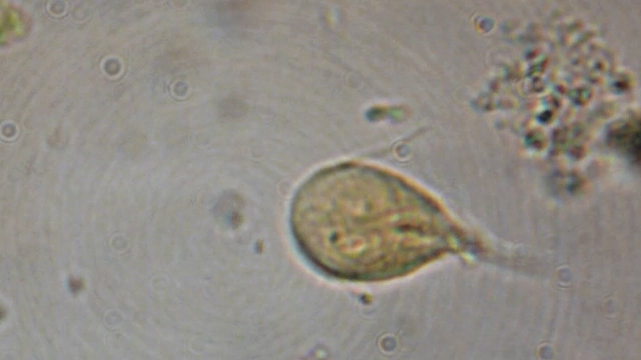 microscopul giardia)
