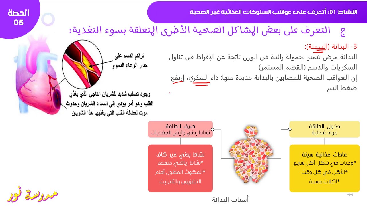 عواقب الإفراط والتفريط في التغذية / أمراض سوء التغذية علوم طبيعية سنة 04 متوسط