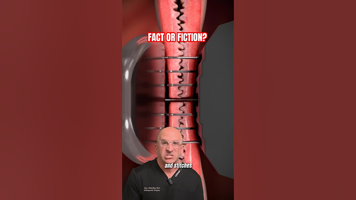 Ant Stitches - The Sci-Fi Trend That Could Save Your Life