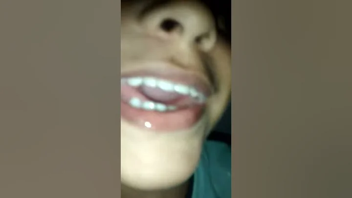 A cavENa