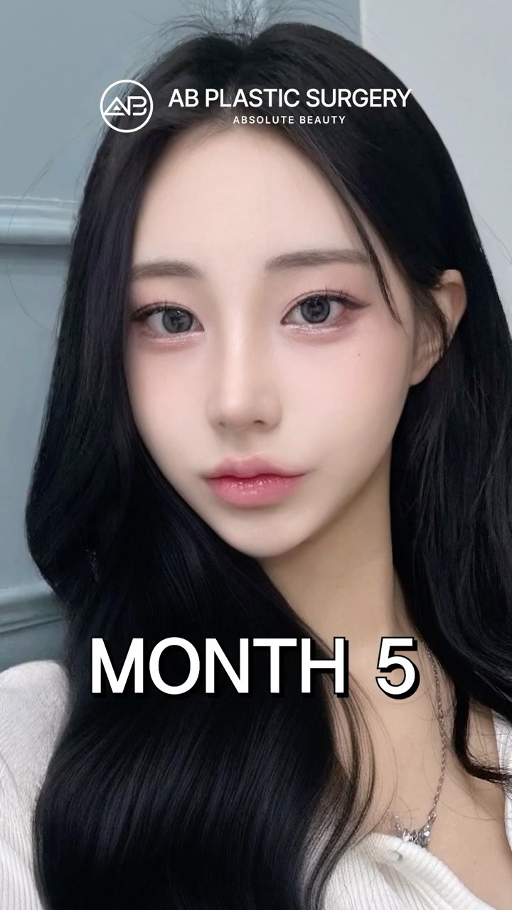 From Cute to Stunning with Eye Surgery and Nose Surgery ✨ #shorts