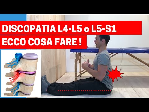 Video: Discopatia Bassotto - Cause E Prevenzione