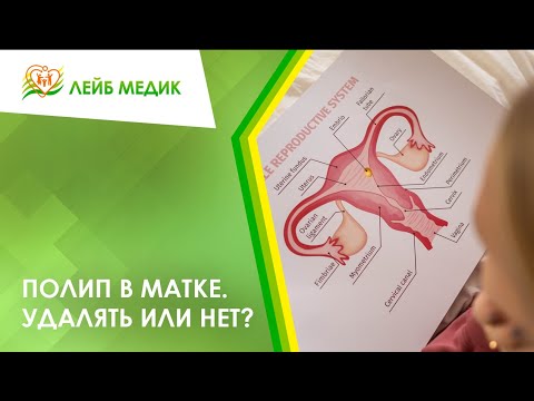 Видео: Кровоточат нераковые полипы?