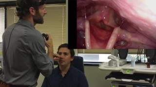matt has a laryngoscopy graphic