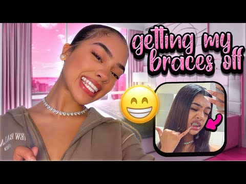 I FINALLY GOT MY BRACES OFF😁 *after 4 years*