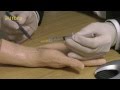 How to Inject the Carpal Tunnel - Tutorial