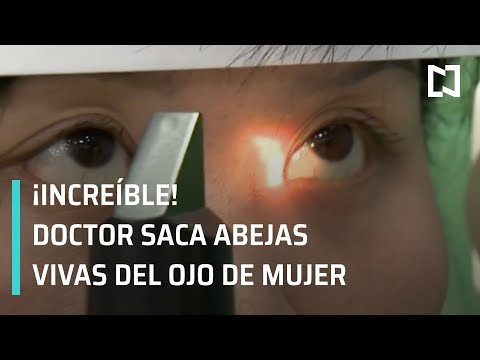 Vídeo: Se Encontraron Cuatro Abejas Vivas En El Ojo De La Niña, Alimentándose De Sus Lágrimas - Vista Alternativa