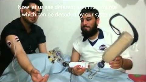 Final Year Project: detection and classification of EMG signals for controlling Prosthetic Arm