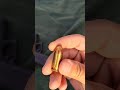 Why 45acp is better than 9mm