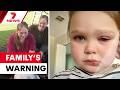 South Australian mother's warning after misdiagnosis leaves daughter blind in one eye | 7NEWS