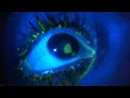OJO Teñido Con Fluoresceína