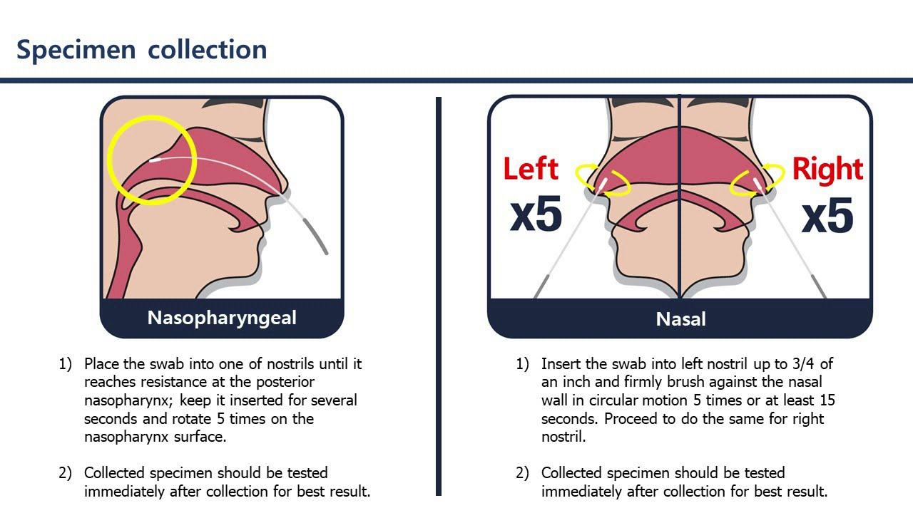 휴마시스, 자가진단키트 국내 도입 선정 유력한 3가지 이유 (휴마시스 주가전망)