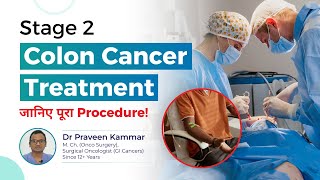 Stage 2 Colon Cancer Treatment जनए पर Procedure Early Detection And Treatment Dr Praveen