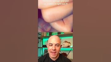 Thumbnail of Derm reacts to failed splinter removal! #dermreacts #doctorreacts #splinter #splinterremoval
