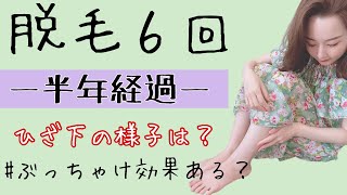 医療脱毛６回終了 効果はあるの 半年後のワイの足 Youtube
