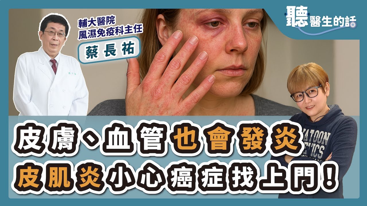 '25.04.02【愛健康│聽醫生的話】蔡長祐醫師談「皮膚、血管也會發炎 皮肌炎小心癌症找上門！」