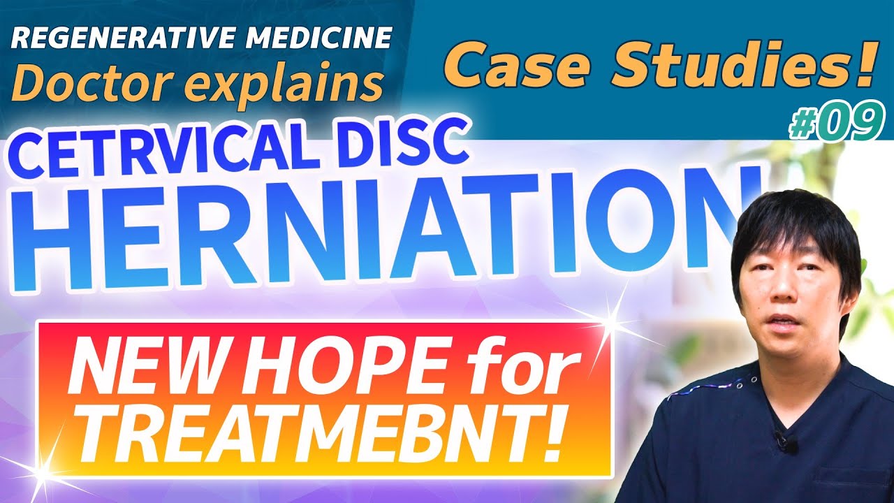 [Regenerative medicine] A new treatment for cervical disc herniation! [Doctor's commentary]