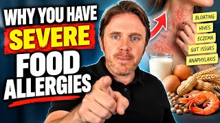 Why Am I Experiencing Severe Food Allergies