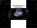 Ultrasound Image Quiz? Wait for the answer #ultrasound #dubai #radiology #medicalimaging #dha