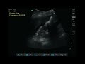 Real-Time Artificial Intelligence–Guided Ultrasonography With Quality and Result Feedback