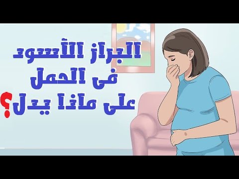 لون البراز الأسود أثناء الحمل ماذا يشير اليوتيوب