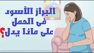 لون البراز الأسود أثناء الحمل ماذا يدل؟