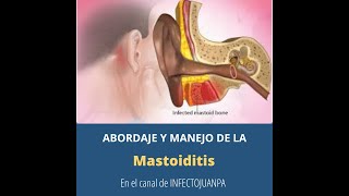 Abordaje y manejo de la Mastoiditis