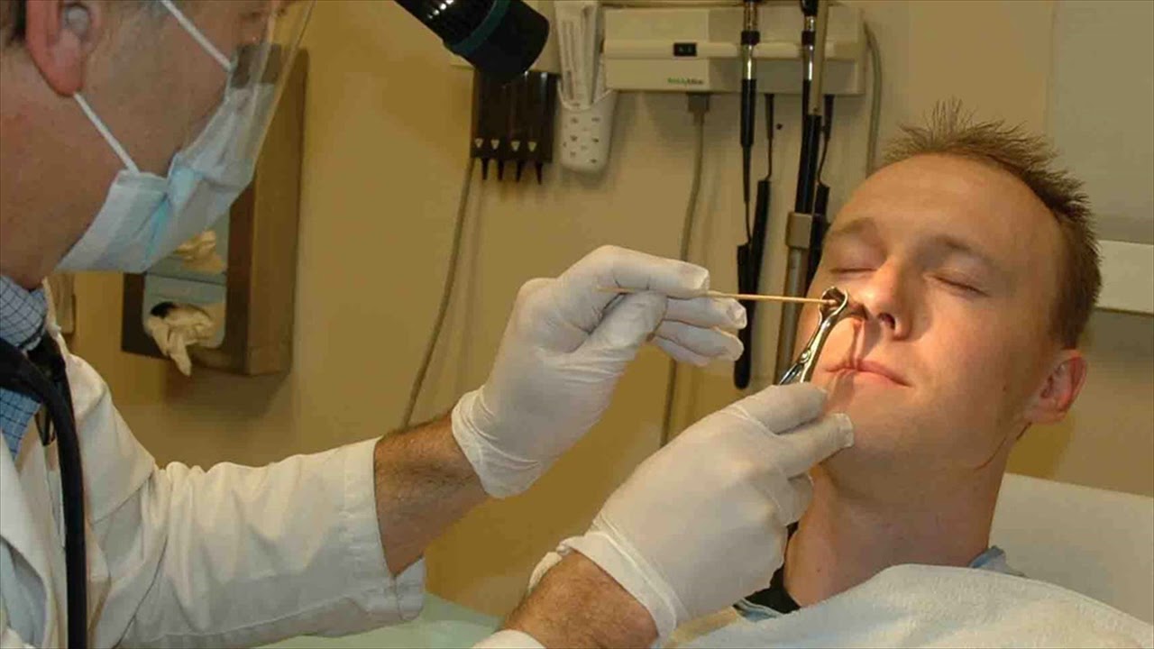 Is Going To Doctor Essential For Nose Bleeding When To Go Is There Any Emergency For Nose 