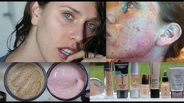 PRODUCTS I USED TO CLEAR MY SKIN (PART 2)