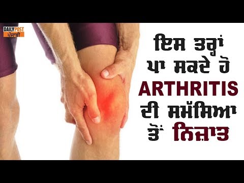 ਇਸ ਤਰ੍ਹਾਂ ਪਾ ਸਕਦੇ ਹੋ Arthritis ਦੀ ਸਮੱਸਿਆ ਤੋਂ ਨਿਜ਼ਾਤ