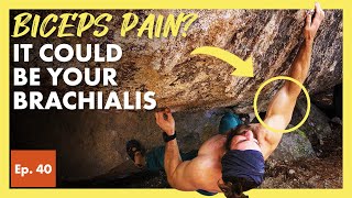 Why the Brachialis Muscle Causes Biceps and Elbow Pain in Climbers