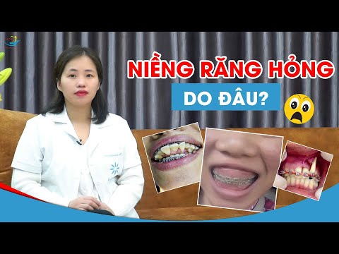 cách vệ sinh răng miệng khi niềng răng tại Kemtrinam.vn