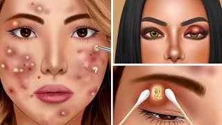 شاهد افضل طريقة لأزالة حبوب الوجة _ eye pimple and acne removal
