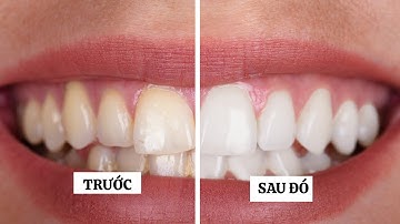 Cách đơn giản để có nụ cười rạng rỡ chỉ với 2 thứ trong bếp!