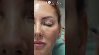 Get a Refreshed Look with Eyelid Surgery